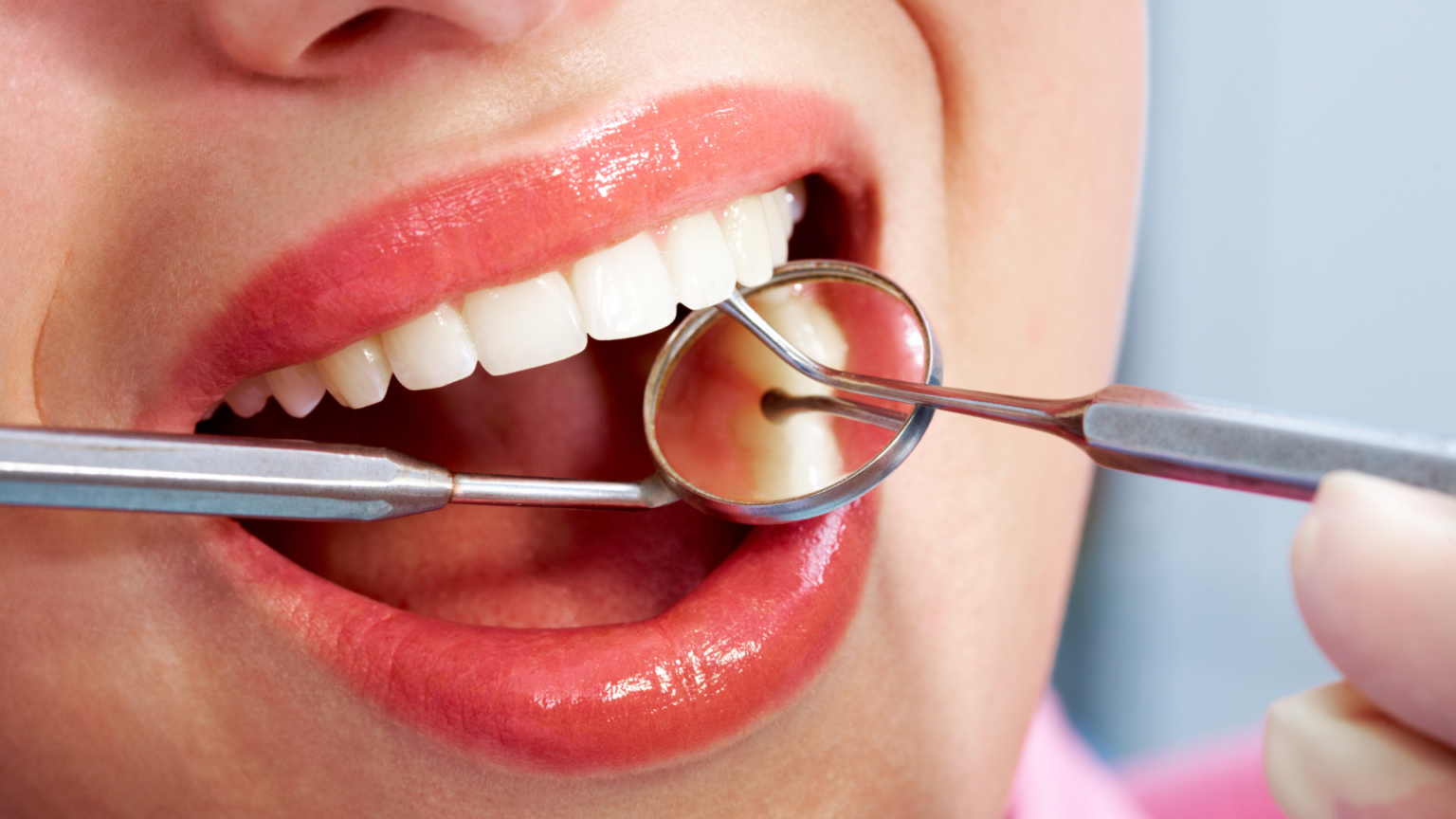 Dental Bonding: The Quick, Easy Way to a Great Smile